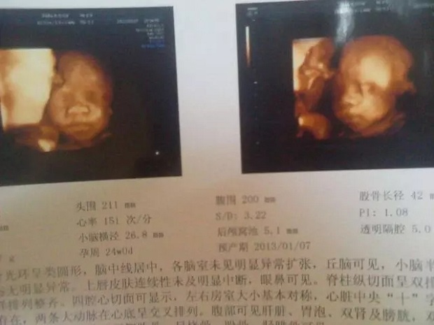 孕期可以做几次四维彩超?常州做四维彩超的医院哪家好？